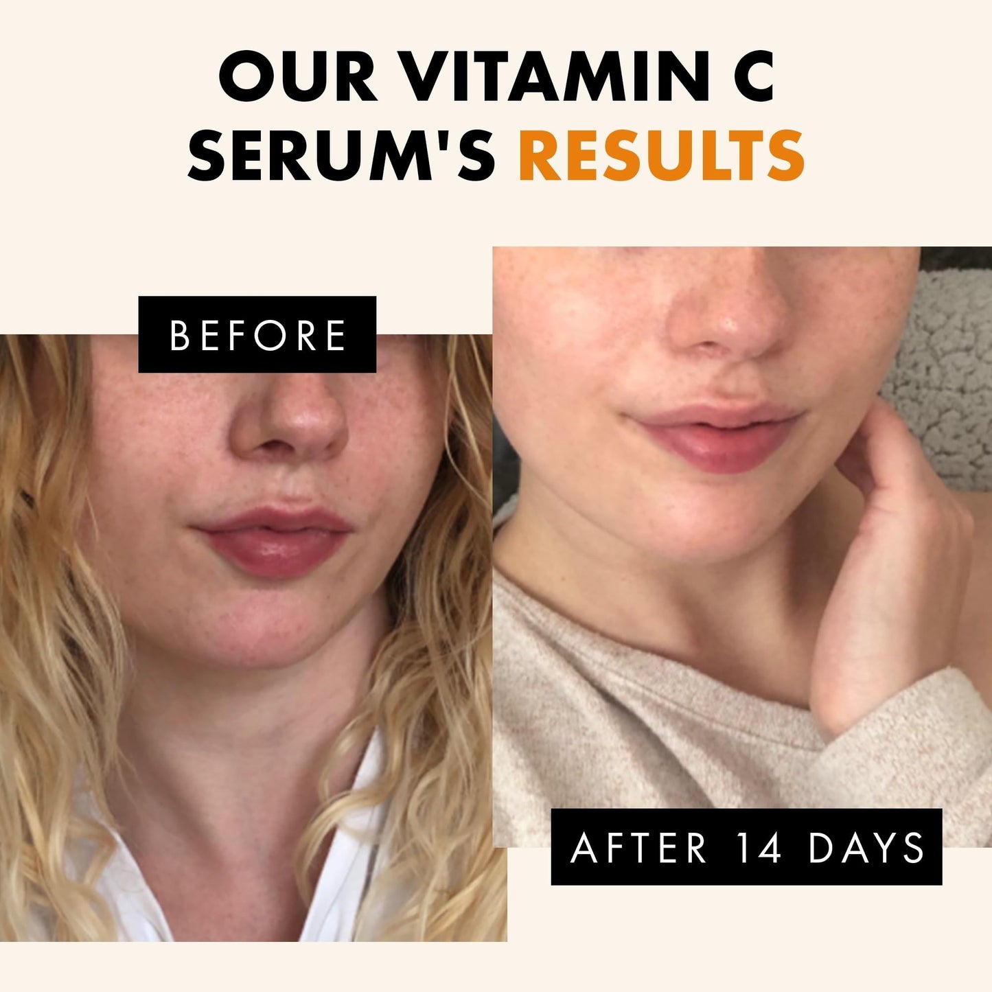 Vitamin C Face Serum - Dark Spot Remover Facial Serum, Vit C Serum with Hyaluronic Acid, Ferulic Acid, & Vit E - Anti Aging and Skin Brightening Serum, Pure Vitamin C Serum Skin Care