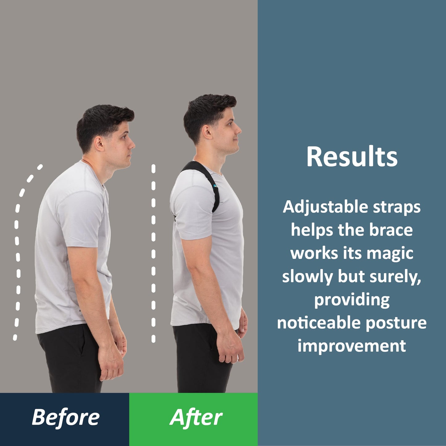 ComfyBrace Posture Corrector-Back Brace for Men and Women- Fully Adjustable Straightener for Mid, Upper Spine Support- Neck, Shoulder, Clavicle and Back Pain Relief-Breathable